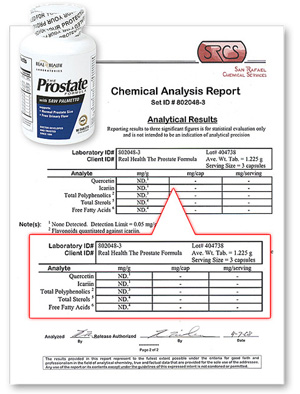 Prostata Lab Report